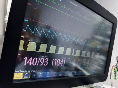 Hastanede elektrokardiyogram..