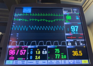 Hastanın kalp monitörünün monitörüne yakın çekim. Hastanın kalbinin monitörüyle..