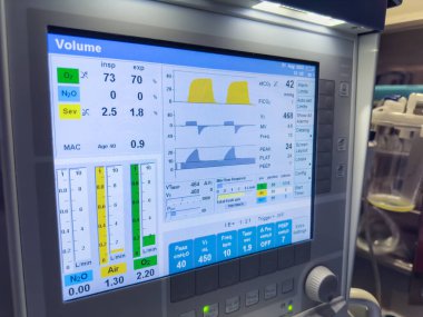 Modern bir makinenin görüntüsü