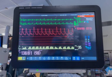 Hastanede elektrokardiyogramla izlenecek.