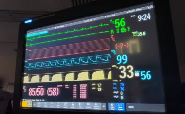 Ekran ekranı olan bir monitörü kapat