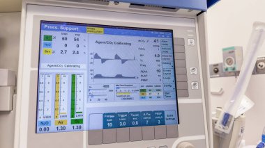 Modern tıbbi ekipmanlar ameliyathanede.