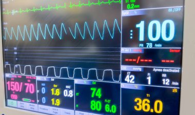 Kardiyogram için elektrokardiyogram ve kalp atış hızı monitörü