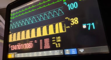 Bir arabanın paneli.