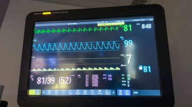 Kardiyogram monitörü. Kalp monitörü. kalp monitörü ile izle.