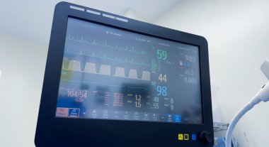 Modern hastanede kardiyogram için modern monitör, yakın çekim