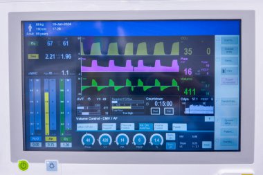 Elektrokardiyogramlı tıbbi monitör