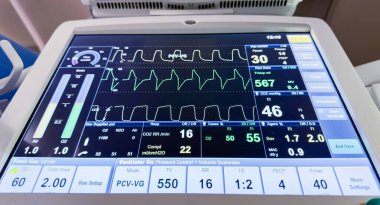 Ameliyat odasındaki kalp monitörünün monitörü ile izleyin.