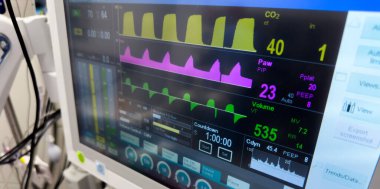 Hastanede elektrokardiyogramla monitör görüntüsü.