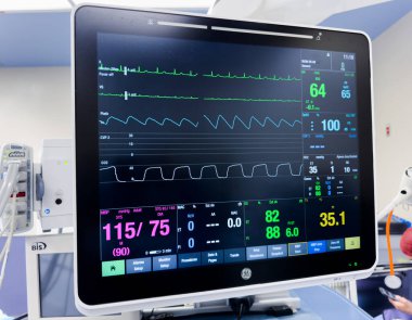 Ameliyat odasındaki kalp monitörü, hasta kalp atış hızında monitörde..