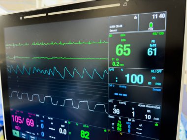 Elektrotlar ve elektrokardiyogramla izle