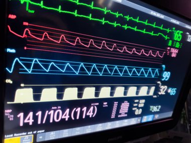 Ekranı ecg monitörü ile izle