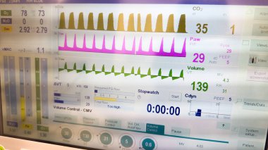 bir bilgisayar monitörünü kapat