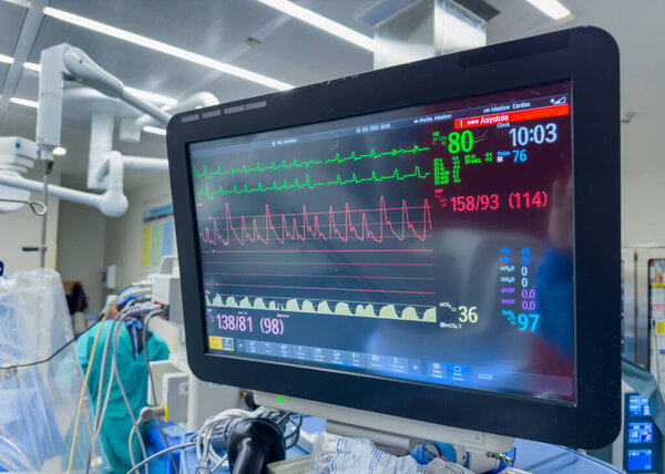 Монитор сердца в больничной палате