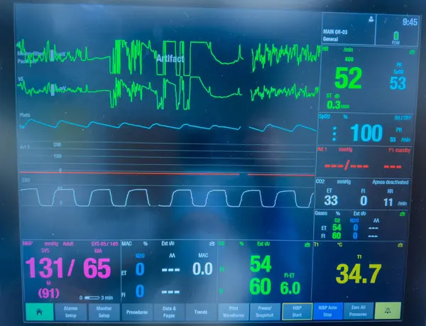 Kalp monitörü kardiyogram ile