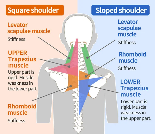 正方形肩部和倾斜肩部的肌肉结构 — 图库矢量图片