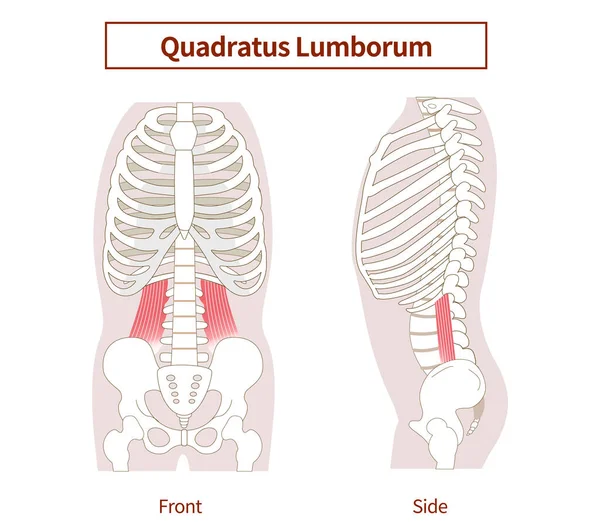 Quadratus lumborum kaslarının yanal ve frontal görünümlerinin gösterimi
