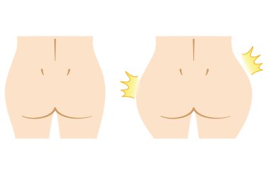 Kadın kalçasının kesme sanatı Güzellik Estetiği