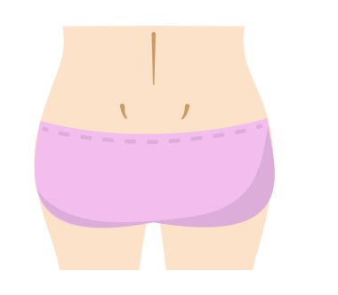 Kadın kalçasının kesme sanatı Güzellik Estetiği