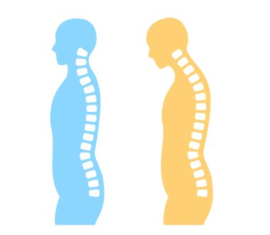 Illustration of straight neck and cervical spine clipart