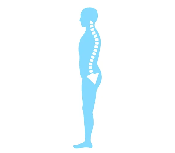 Pelvic Forward Backward Tilt Correct Posture Body Illustration — Stock Vector