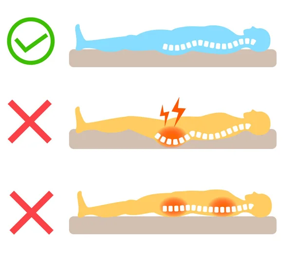 stock vector Causes of back pain: Relationship between the spine and mattresses and bedding