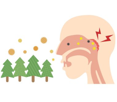 Nasofarinks 'e yapışmış uçan polenlerin neden olduğu rhinitis' li birinin profili