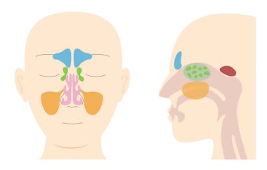 Illustrative illustrations of the anatomy of the paranasal sinuses from frontal and lateral sagittal plane views clipart