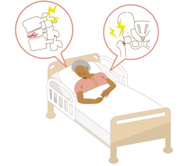 Osteoporoz nedeniyle uyluk kemiği ve omurga kırıkları olan yaşlı siyah bir kadın yatağa hapsedilmiş.