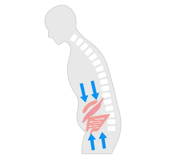 Stock vector Silhouette of a person whose internal organs are compressed due to poor posture caused by a stooped back