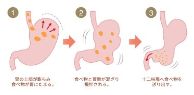 Midenin yiyecekleri nasıl sindirdiğini açıklayan bir resim.