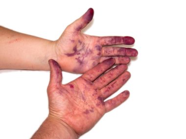 İki el, muhtemelen erkek ve kadın, açık arkaplanda koyu mor dut suyu ile lekelenmiş. Hasatın, ev yapımı hazırlıkların ve doğallığın sembolü..