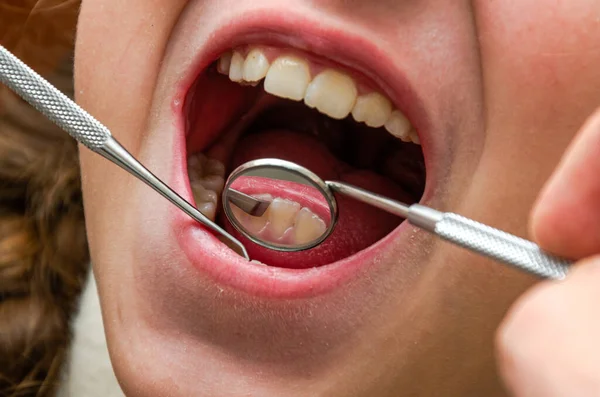 歯科用鏡で患者の歯を調べる歯科医 — ストック写真