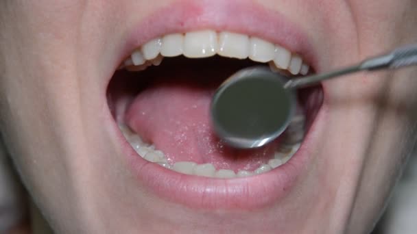 Dentista Examinando Los Dientes Del Paciente Con Espejo Dental — Vídeo de stock