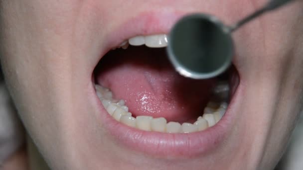 Tandläkare Undersöker Patientens Tänder Med Tandspegel — Stockvideo