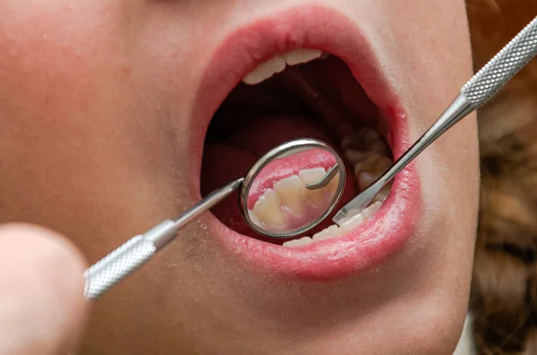 Dentista Examinando Los Dientes Del Paciente Con Espejo Dental — Foto de Stock