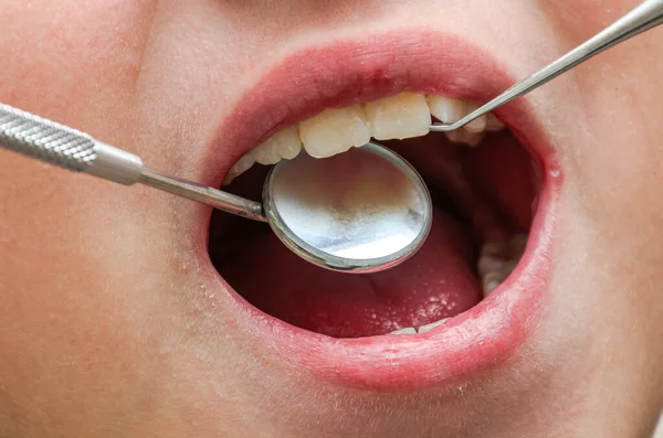 Dentista Examinando Los Dientes Del Paciente Con Espejo Dental — Foto de Stock