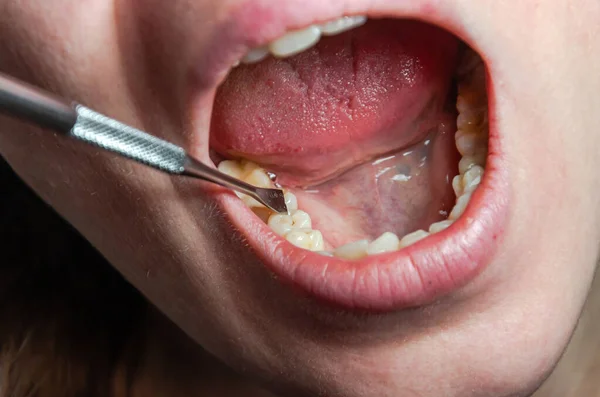 歯医者は歯を患者に治療し — ストック写真