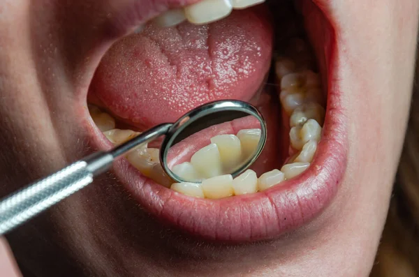 歯医者は歯を患者に治療し — ストック写真