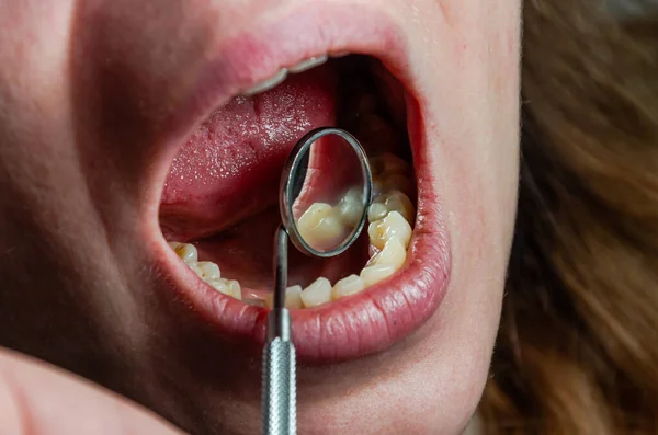 牙医治疗病人的牙齿 — 图库照片