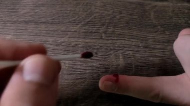 Doktor, kesik parmak için ilk yardım yapıyor.