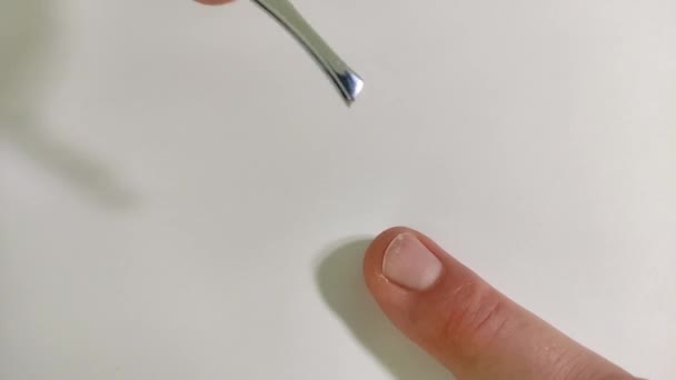 Erste Hilfe Für Einen Patienten Mit Gebrochenem Fingernagel — Stockvideo