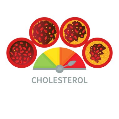 Kan damarı tıbbi diyagramında kolesterol plağı birikimi. LDL ve HDL lipoprotein ölçer. Yüksek ve düşük yağ testi göstergesi. Atheroskleroz riski var. Sağlık sigortası konsepti. Vektör illüstrasyonu