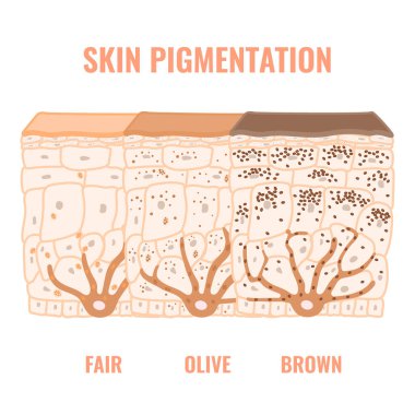 Melanin içeriği ve farklı cilt tonlarında dağıtım. Koyu, zeytinli ve açık tenli pigmentasyon mekanizması. Epidermis enine kesitli enfografik tıbbi diyagram. Vektör illüstrasyonu.