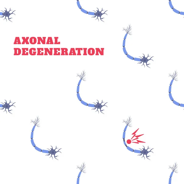 Degenerace Axonálního Nervu Ztráta Komunikace Mezi Neurony Vzorec Vnímání Nemoci — Stockový vektor