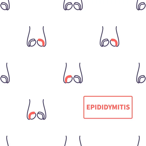 Epididymit Sjukdomskännedom Inflammation Testikelspolat Rör Testiklar Anatomi Diagram Mönster Manlig — Stock vektor