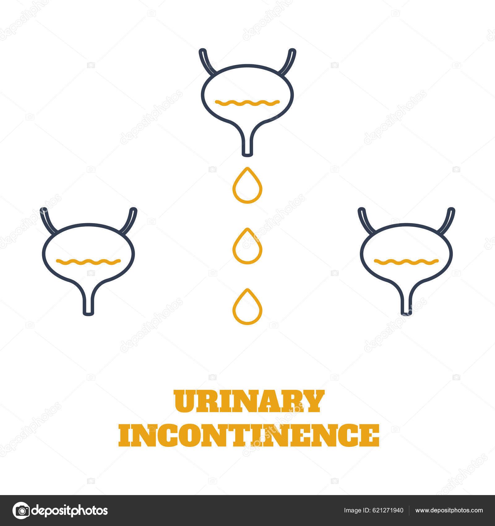 Urinary Incontinence Condition Loss Bladder Control Urologic Disease ...