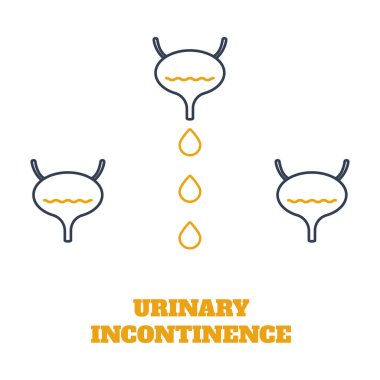 Urinary incontinence condition. Loss of bladder control. Urologic disease awareness pattern. Human body anatomy concept. Medical vector illustration. clipart