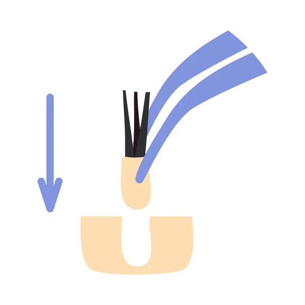 Symbolem Leczenia Kleszczy Przeszczepu Włosów Chirurgiczne Pęsety Wyrywające Mieszki Włosowe — Wektor stockowy