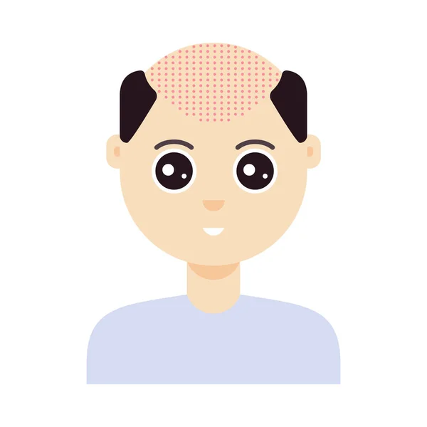 Fue Hair Transplant Treatment Alopecia Front View Man Surgery Male — Stock Vector